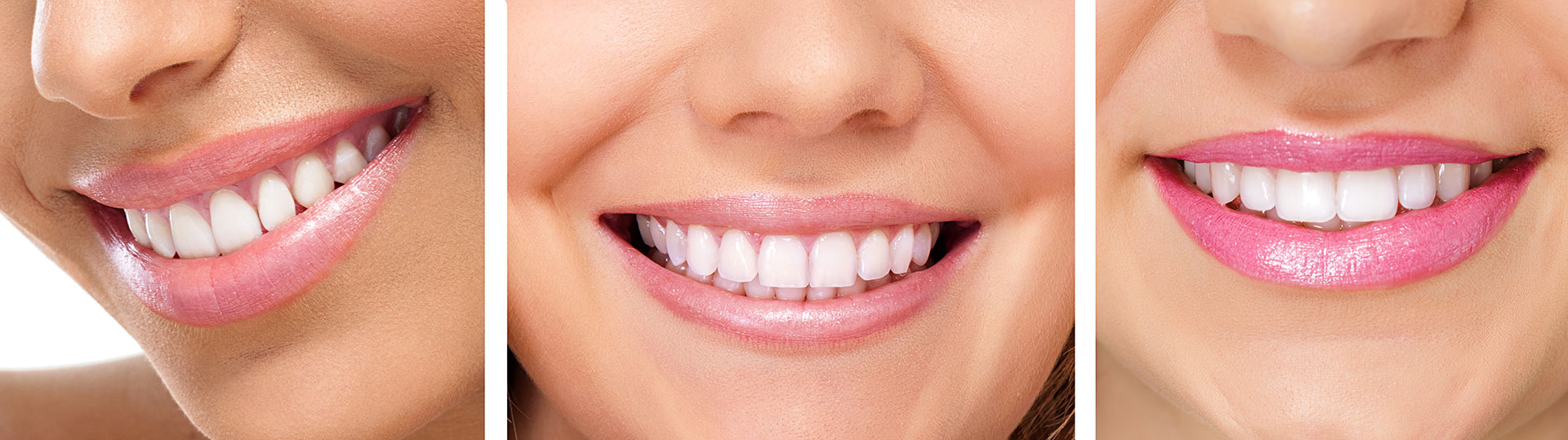 Гигиена зубов и полости рта